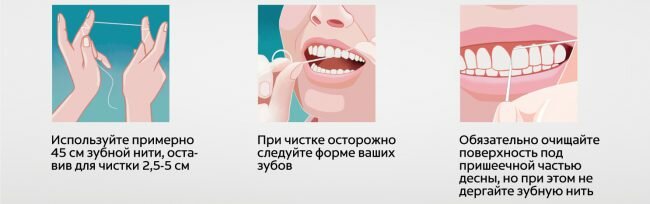 техника очистки зубной нитью